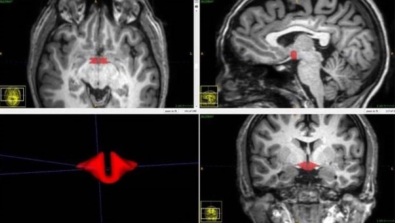 Click to enlarge Brain MRI Images