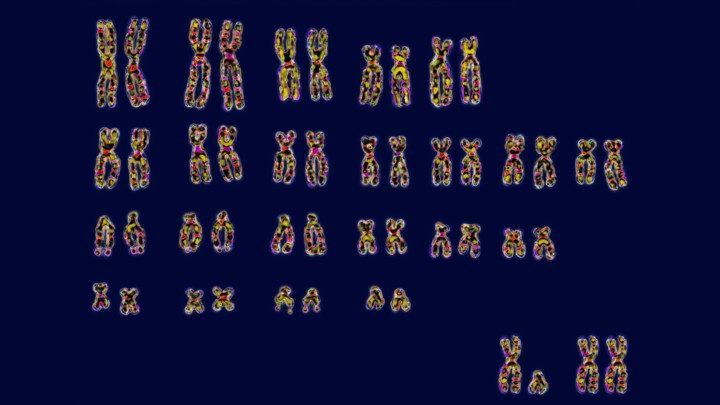 Click to enlarge Human Chromosomes