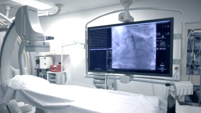 heart scan