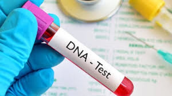 Click to enlarge DNA test