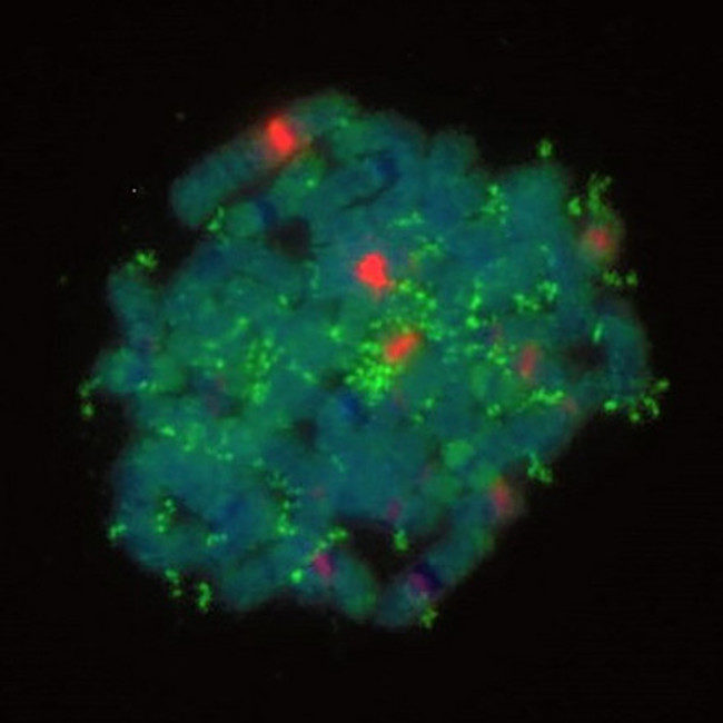 DNA of a neuroblastoma cell