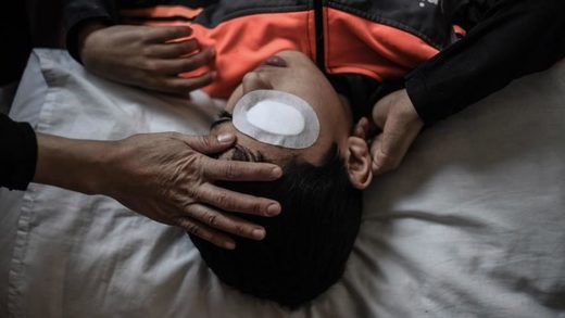 Not content with crippling Palestinian protesters, Israeli snipers now target Gazans' eyes - Over 50 permanently blinded