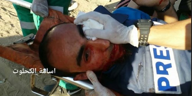 Click to enlarge Sami Misran reporter blinded gaza