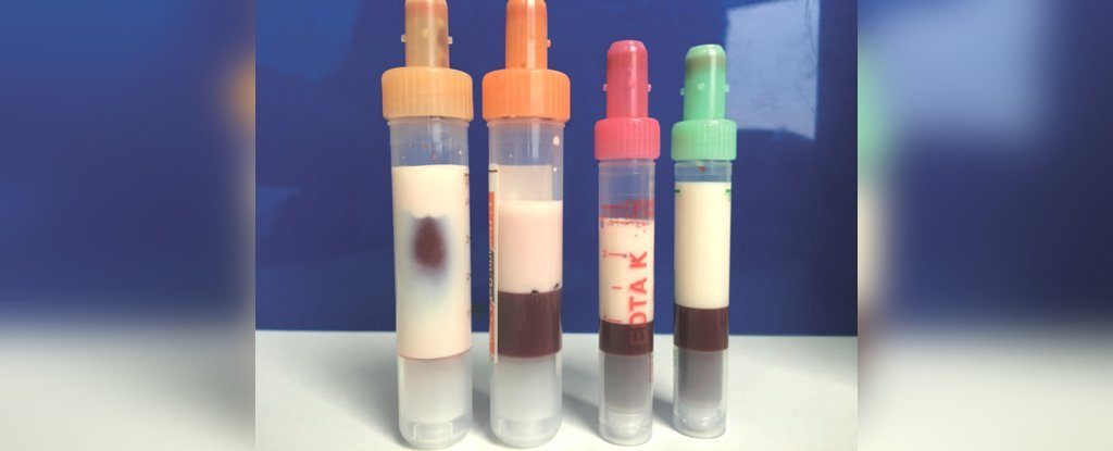 Click to enlarge fatty blood