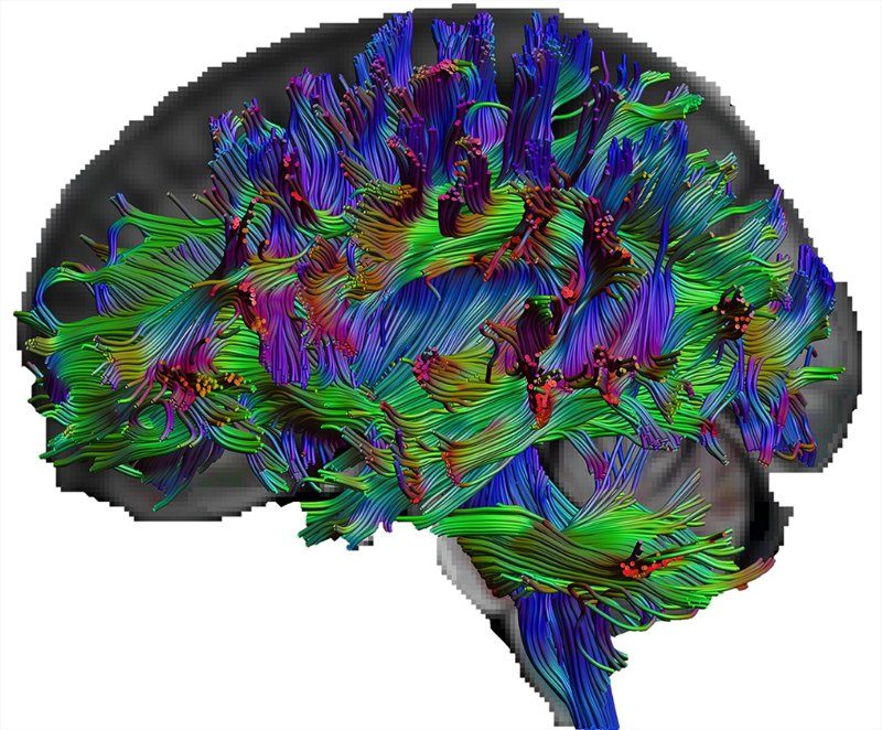 brain
