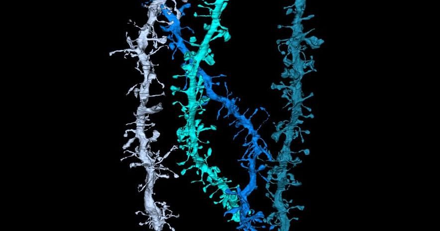 Dendrites