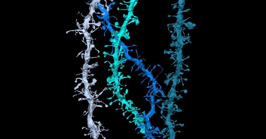 neurons dendrites brain