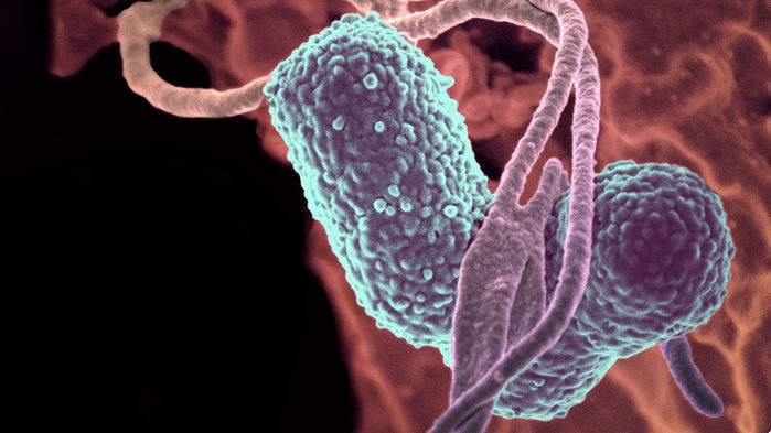 Klebsiella pneumoniae