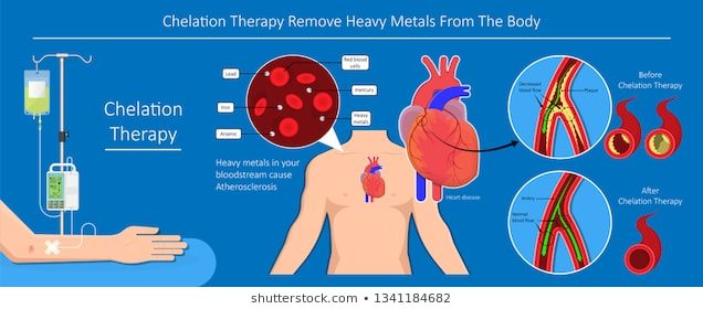 chelation, heavy metals