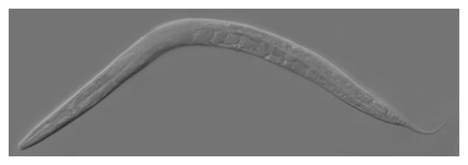 Click to enlarge C. Elegans Worm