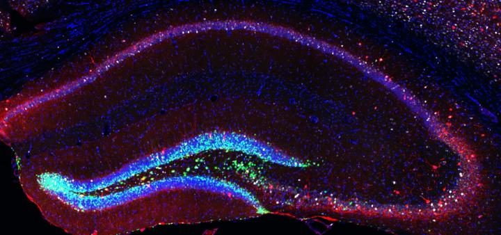 mouse neural stem cells
