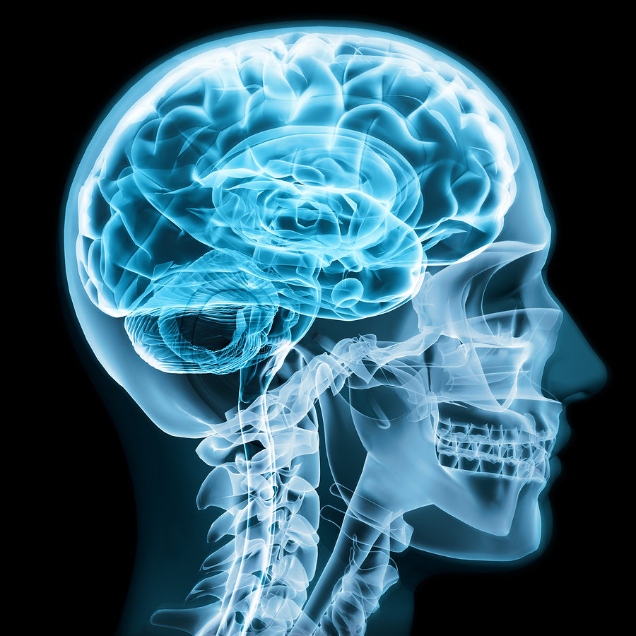 brain x-ray