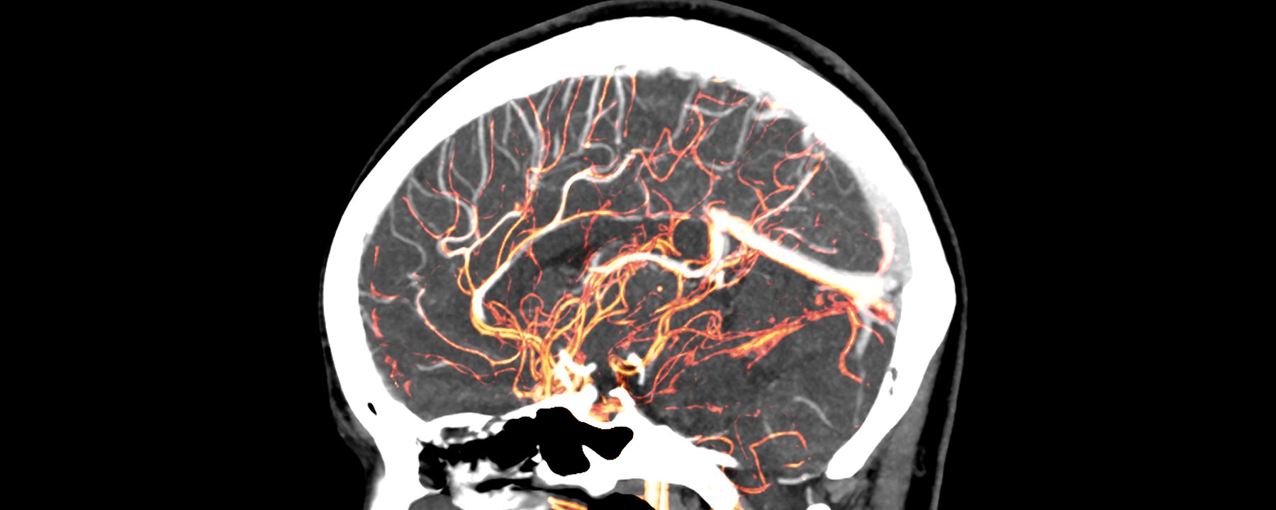 brain