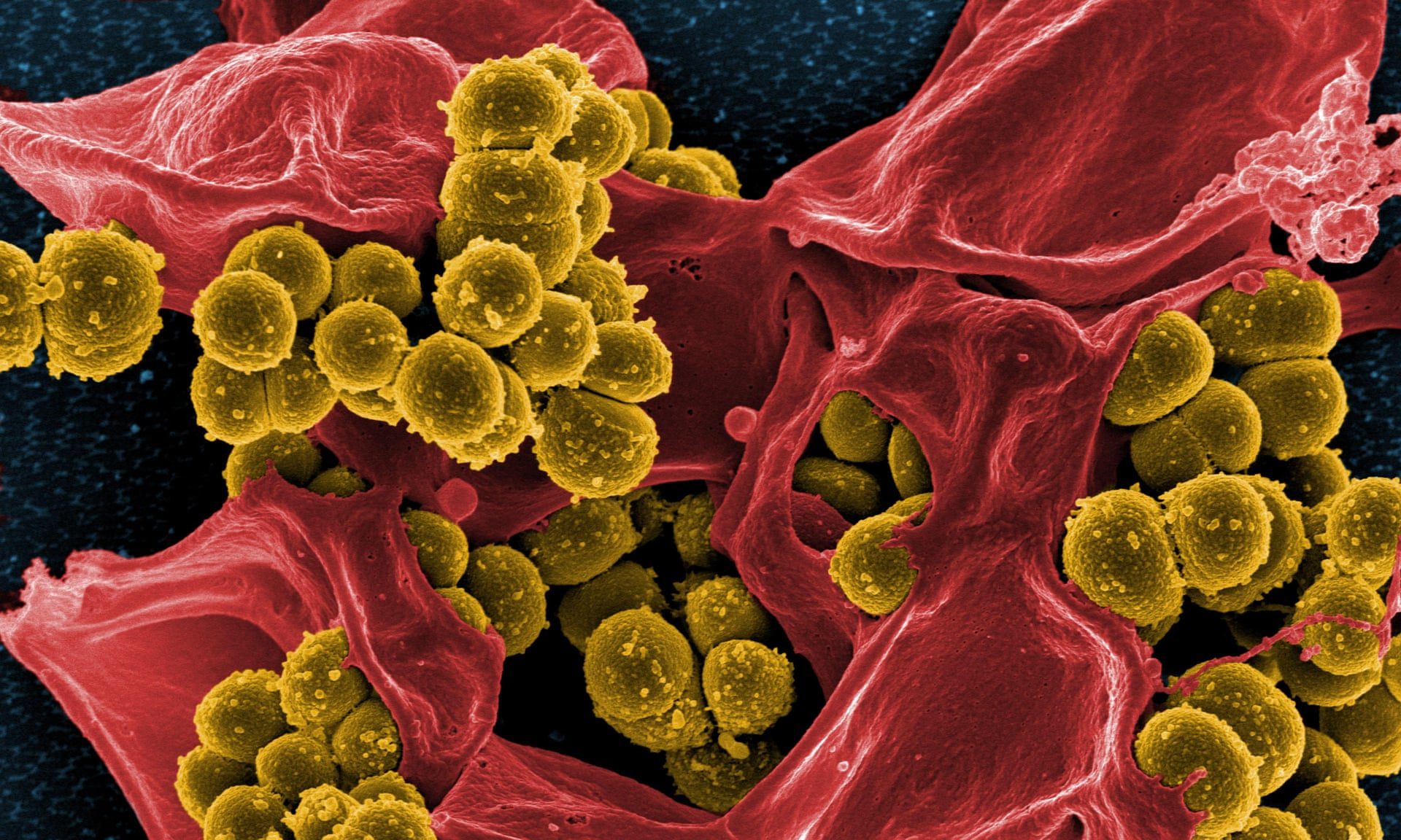 MRSA