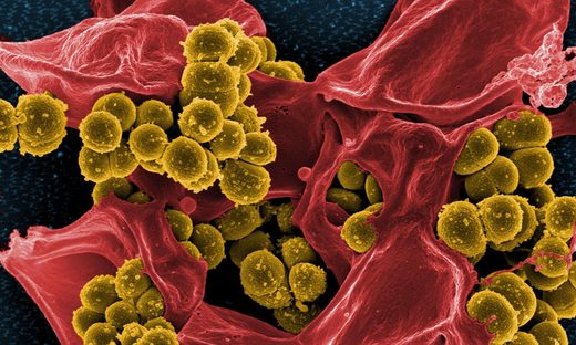 Cannabis compound found to wipe out superbugs