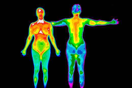 Human body temperature has declined steadily over the past 160 years