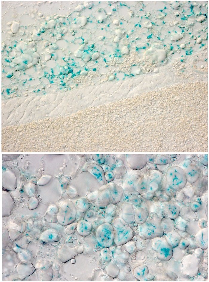 Click to enlarge fatt cells