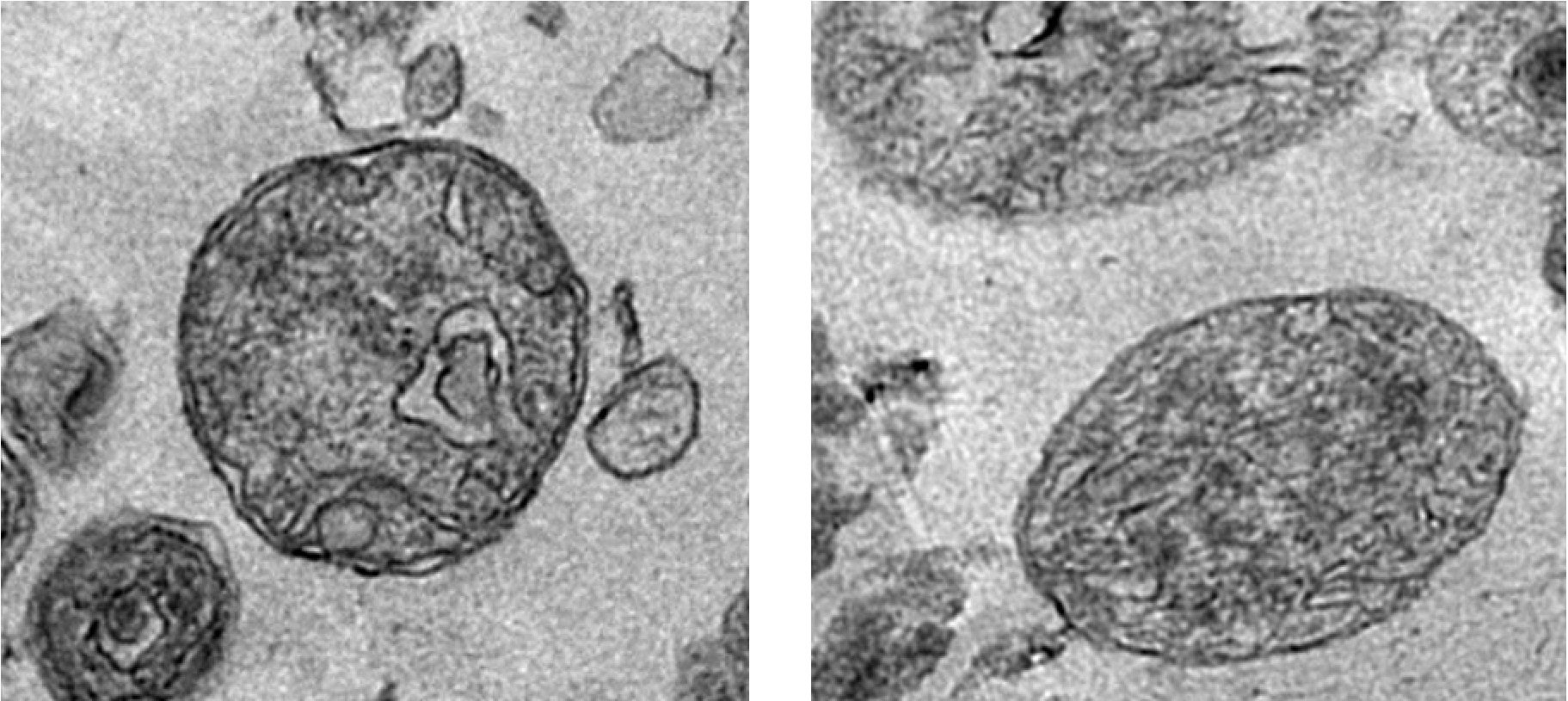 Click to enlarge extracellular mitochondria