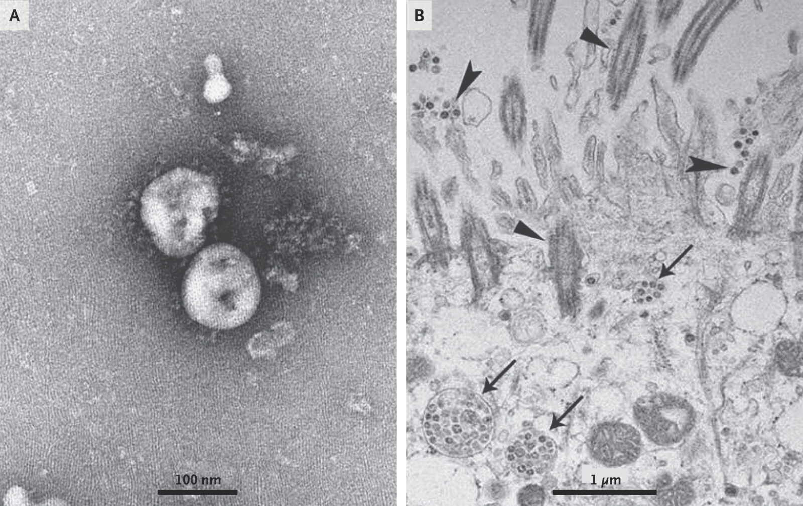 Click to enlarge coronavirus microscope