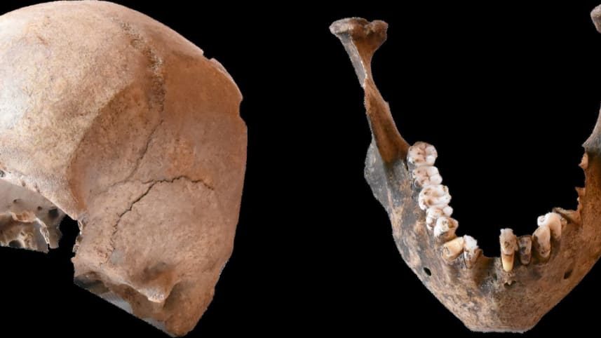 Click to enlarge skull