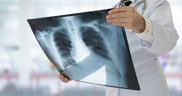 X-ray