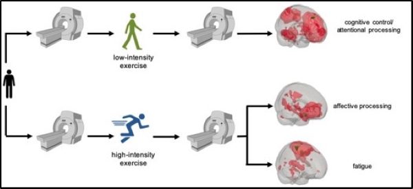 Click to enlarge high low exercise mri