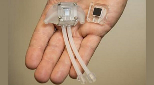 Artificial kidney