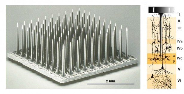Click to enlarge implanted array