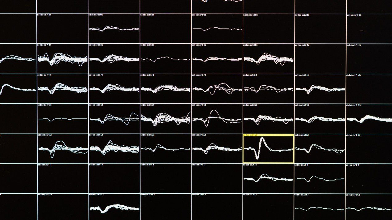 electrical signals brain