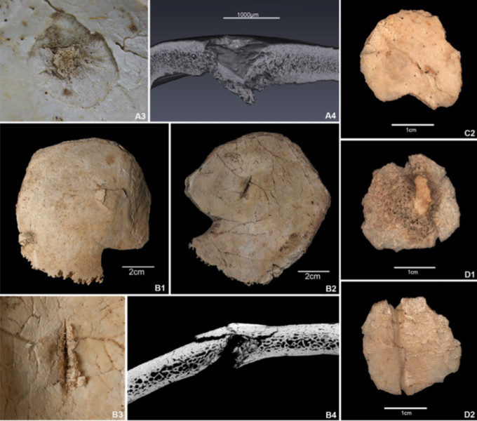 Click to enlarge Fossil Bones