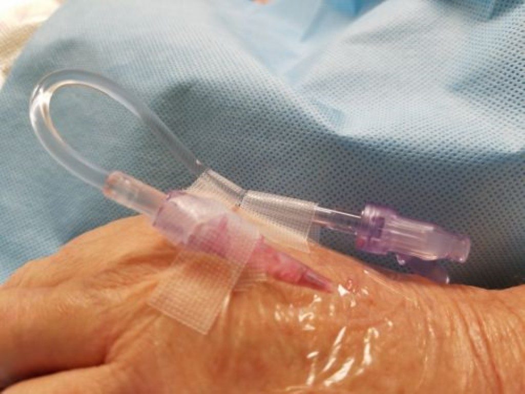 IV needle