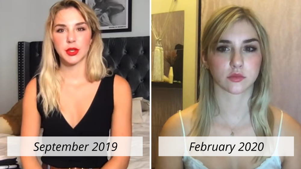 mikhaila Peterson before after Jordan illness