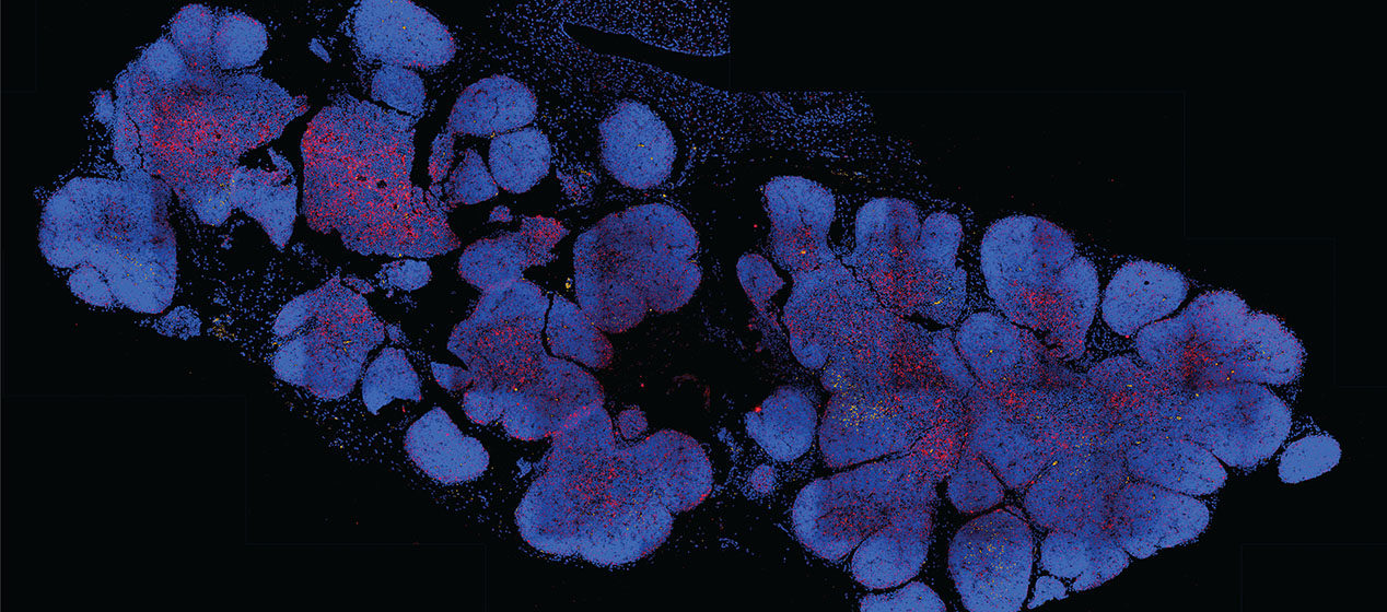 Human Thymus