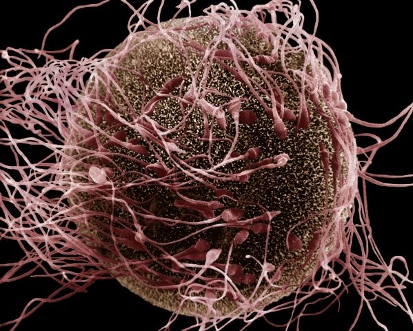 Click to enlarge human egg and spermatozoa