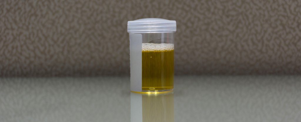 urine