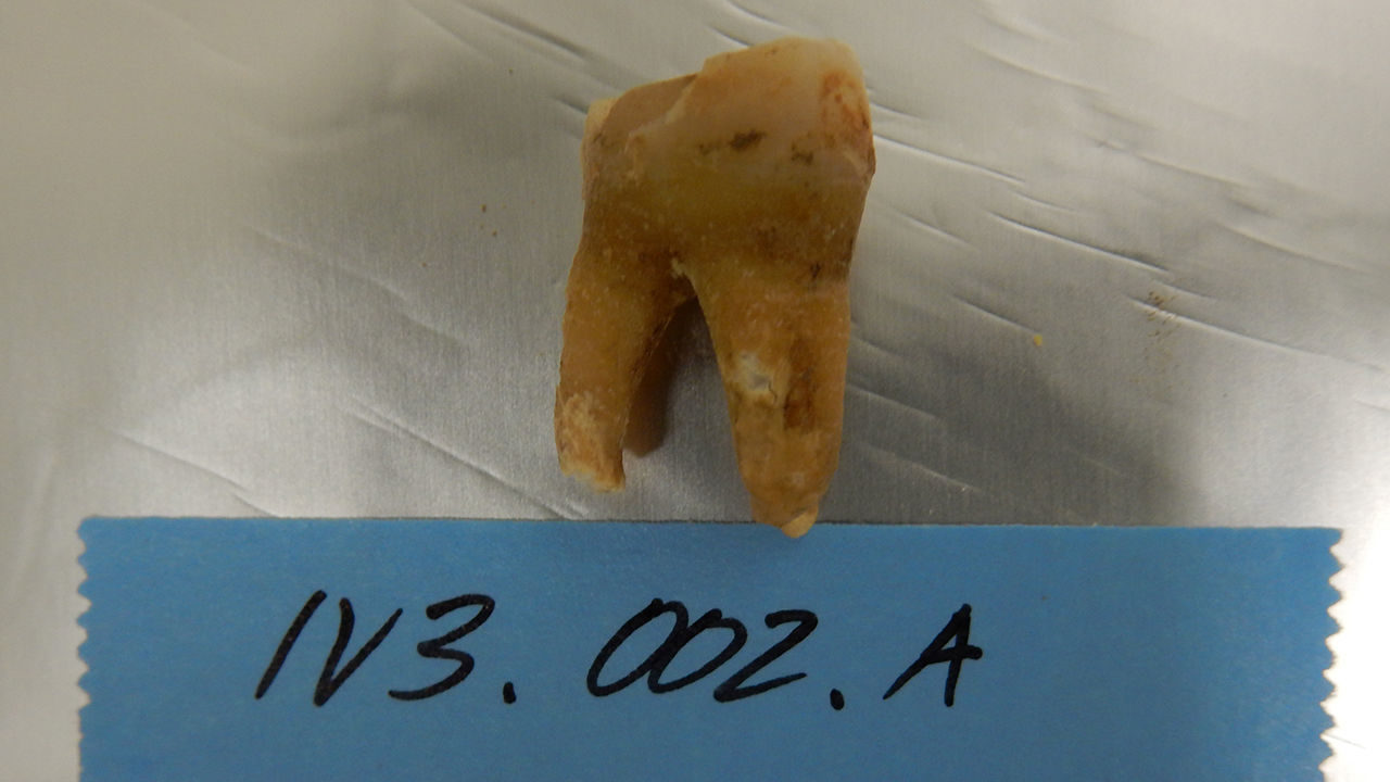 Click to enlarge tooth