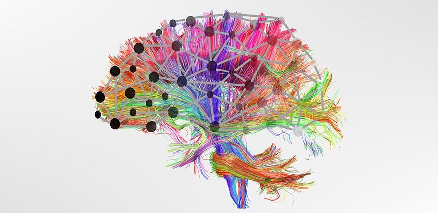 Brain Connectivity