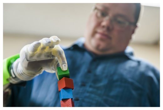 Click to enlarge Controlling Prosthetic