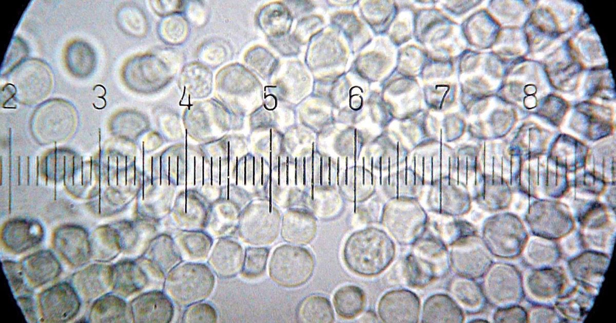 Saccharomyces cerevisiae, laboratory yeast
