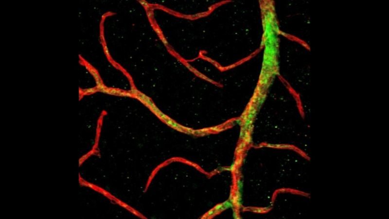 Human vascular progenitor cells (green)