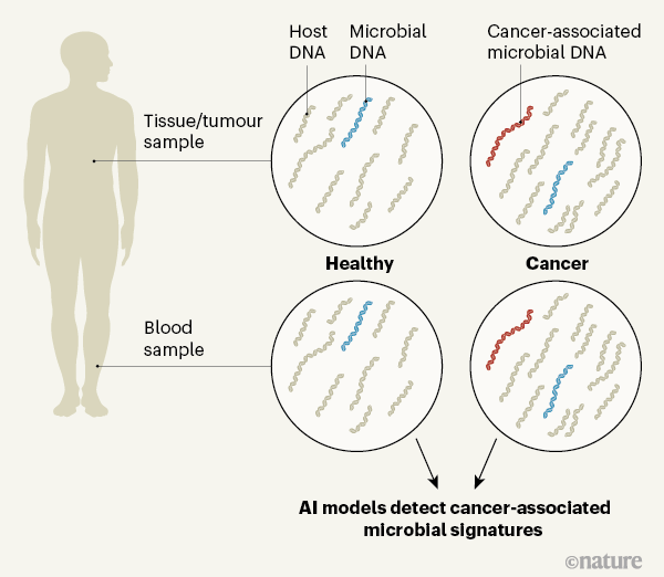 Click to enlarge AI detects cancer microbe signature