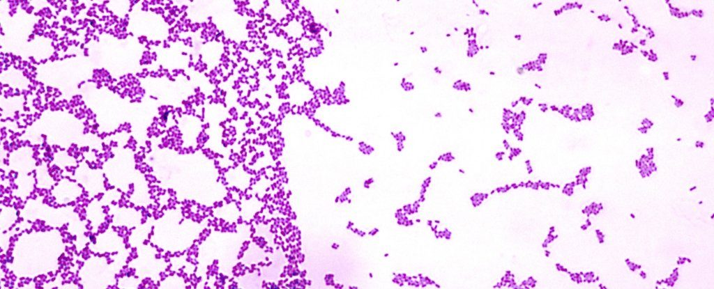 Streptococcus