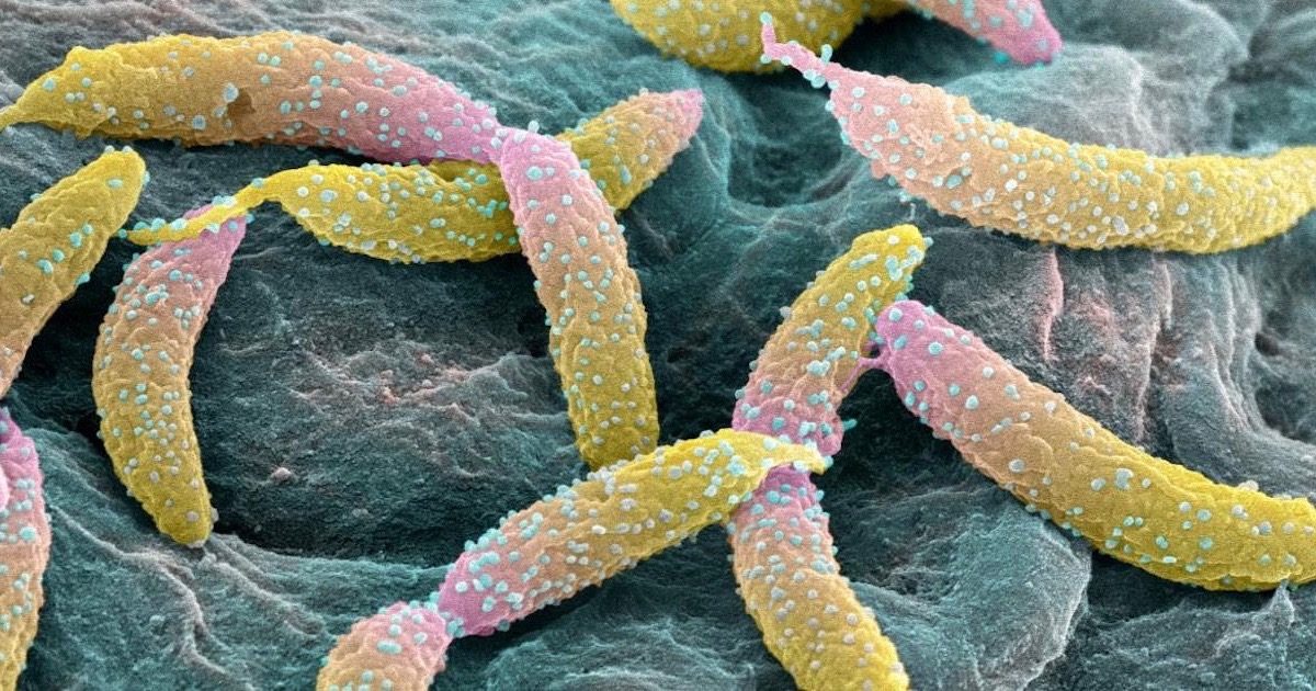 Caulobacter crescentus
