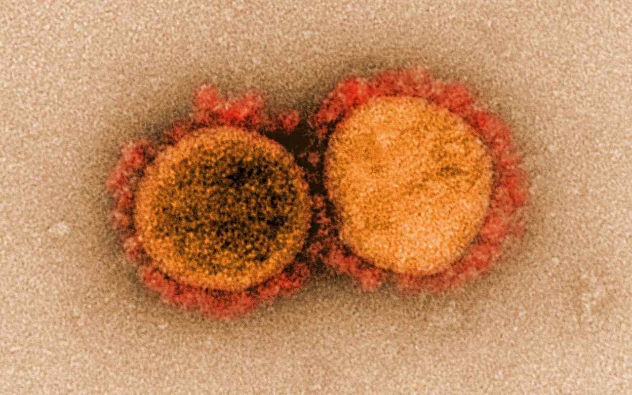 coronavirus microscope