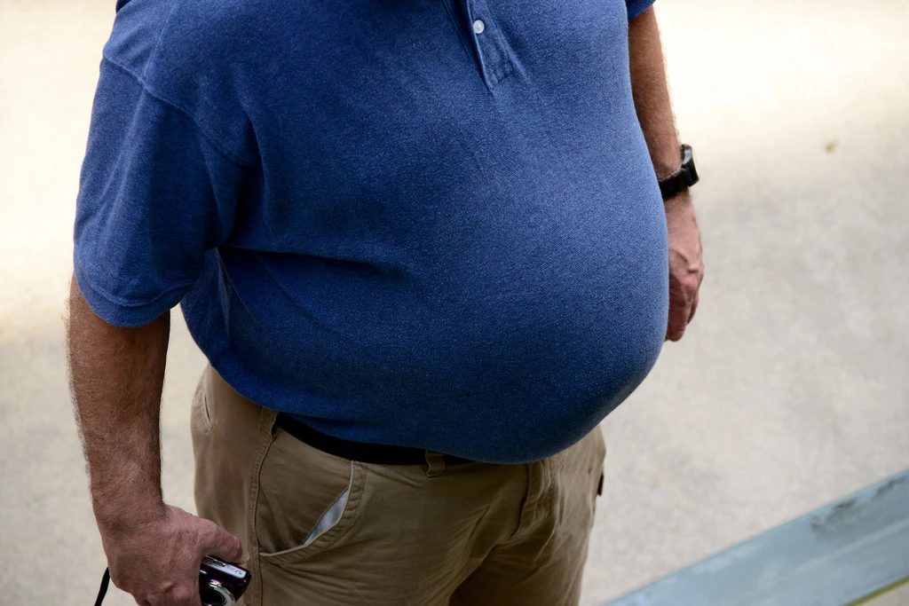 obese figure