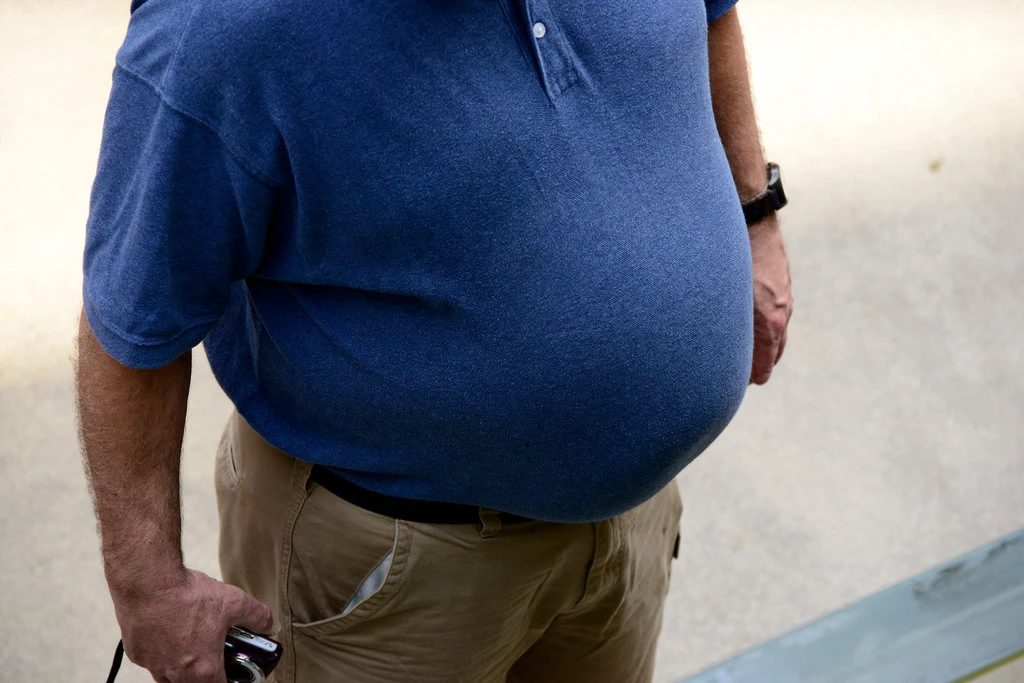 Click to enlarge obesity obese fat