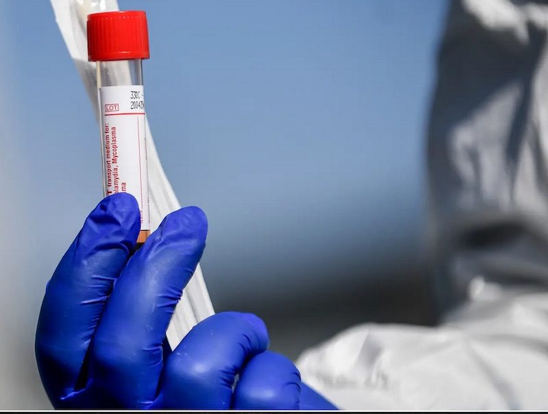 Click to enlarge Coronavirus test.