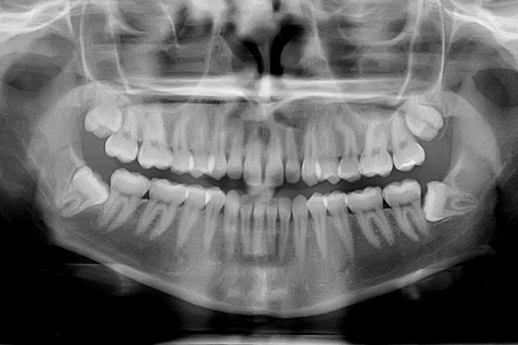 Click to enlarge teeth tooth