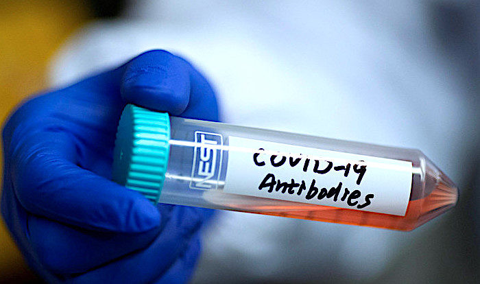 Click to enlarge VialAntibodies