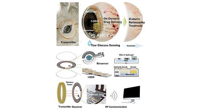 Click to enlarge smart eye contact lens diabetes